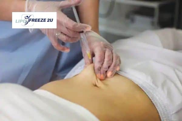 How Does Aqualyx Fat Dissolving Injection Work to Break Down Fat Greater London?