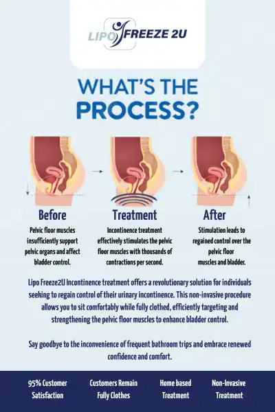 Diagram of how incontinence treatment Greater London works.
