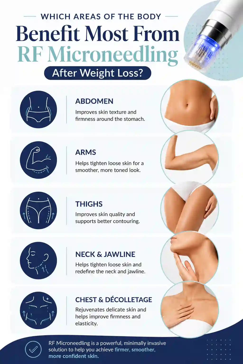 Which Areas of the Body Benefit Most From RF Microneedling After Weight Loss Greater London